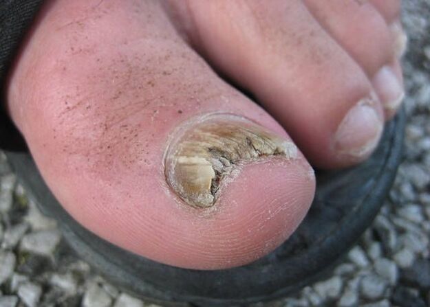 The result of indifference