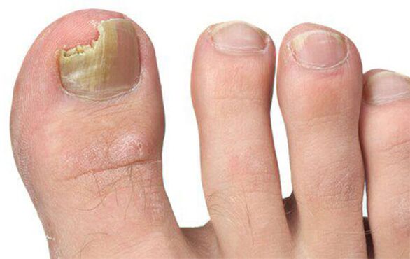 Different forms of fungi