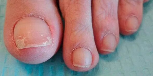 Stages of mushroom legs