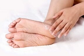 foot skin fungus treatment with cream