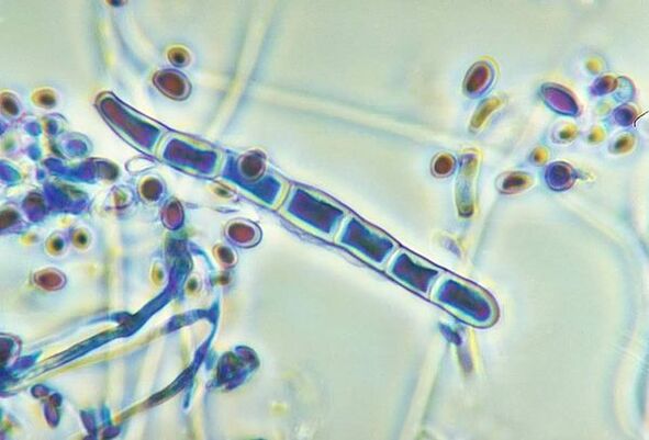 Fungus Trichophyton rubrum under a microscope