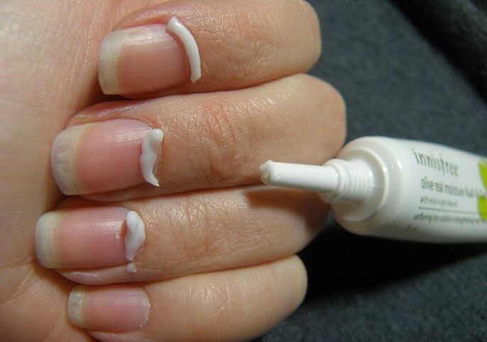 nail fungus treatment with ointment