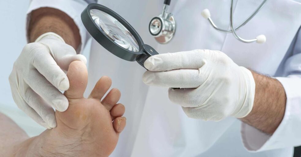 the doctor checks the feet for fungus